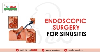 Endoscopic Surgery for Sinusitis